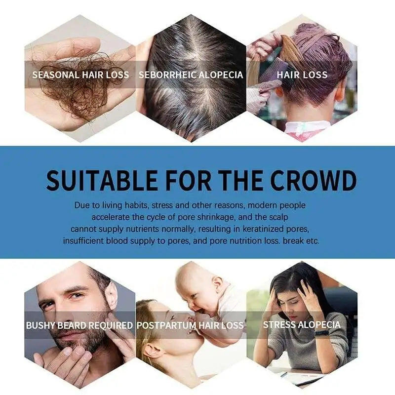 Minoxi Roll-on Hair Growth Serum: Nourishing Scalp Treatment for Thicker, Fuller Hair