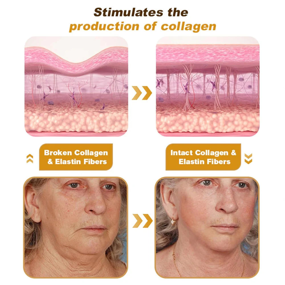 botox-bee-venom-wrinkle-repair-cream-🐝✨