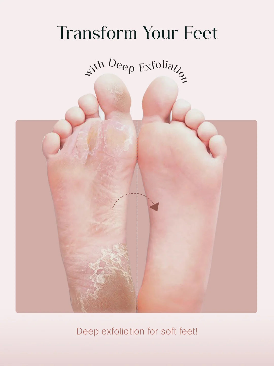 THE SEOULSKIN GLYCOLIC ACID FOOT PEELING MASK PACK OF 1