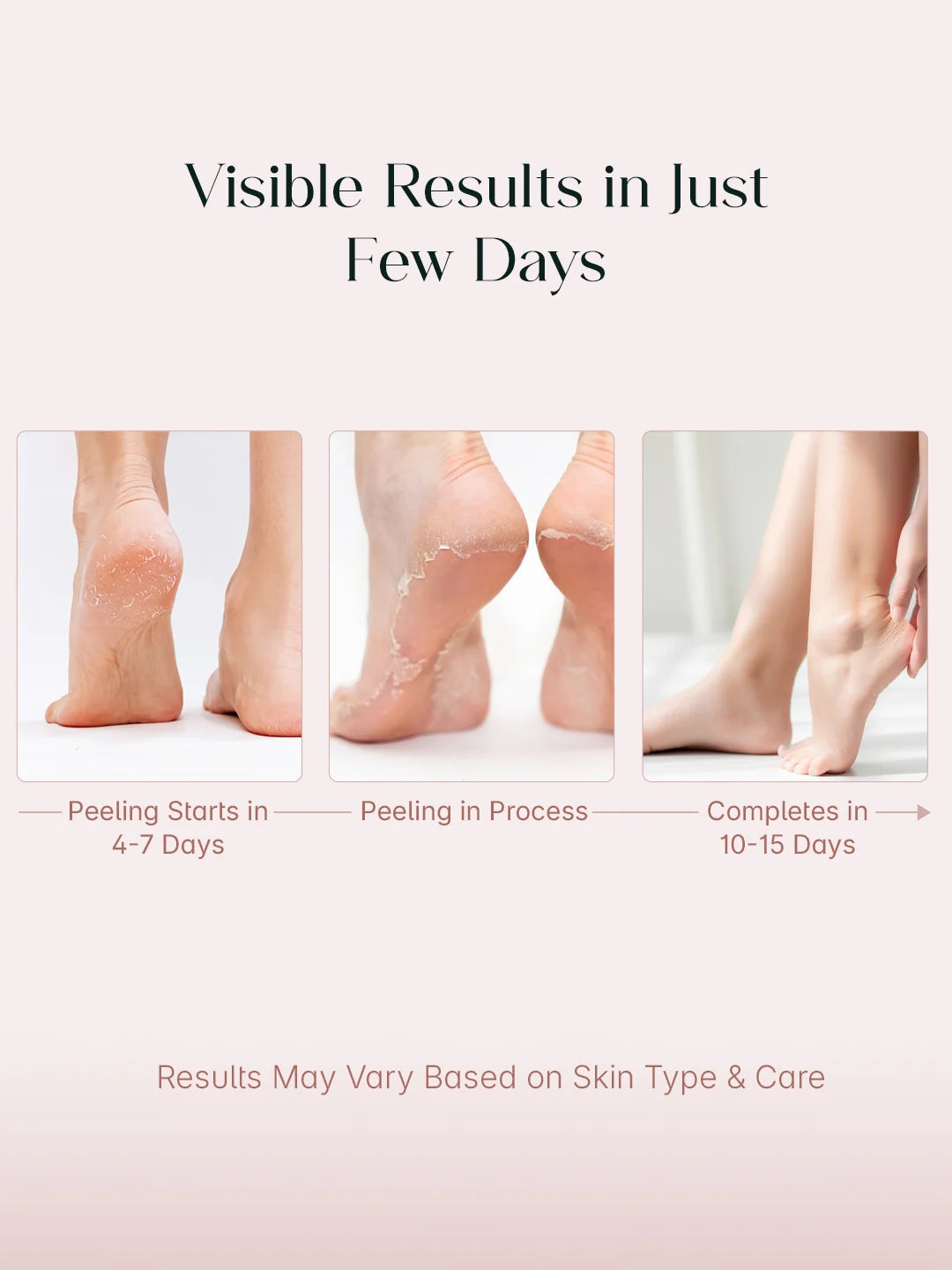 THE SEOULSKIN GLYCOLIC ACID FOOT PEELING MASK PACK OF 1