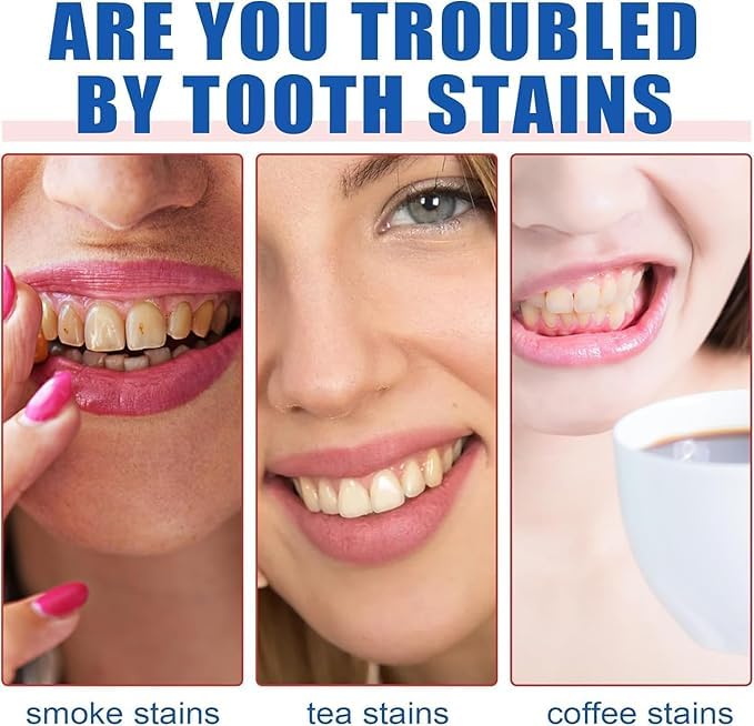 SP 4 probiotic whitening toothpaste, Ultra Brightening Toothpaste, Advanced Whitening Formula for Stain Removal and Enamel Protection