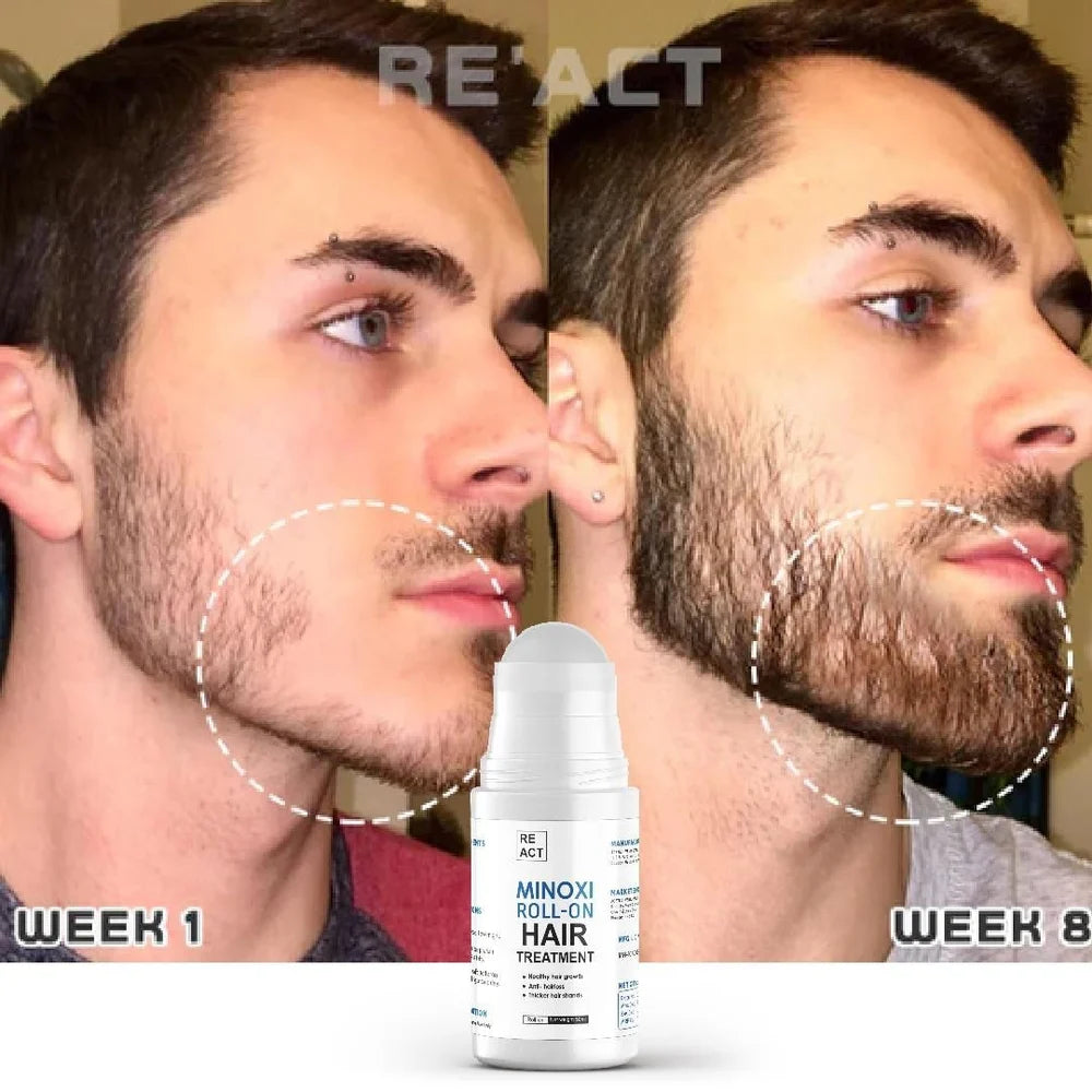 Minoxi Roll-on Hair Growth Serum: Nourishing Scalp Treatment for Thicker, Fuller Hair