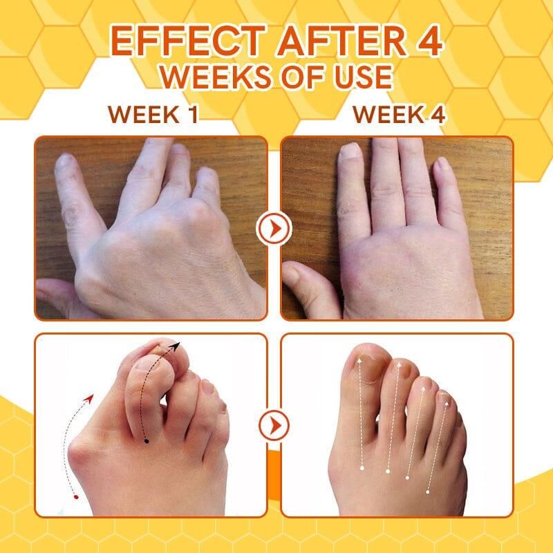 🐝 Bee Venom Spider Veins Spray