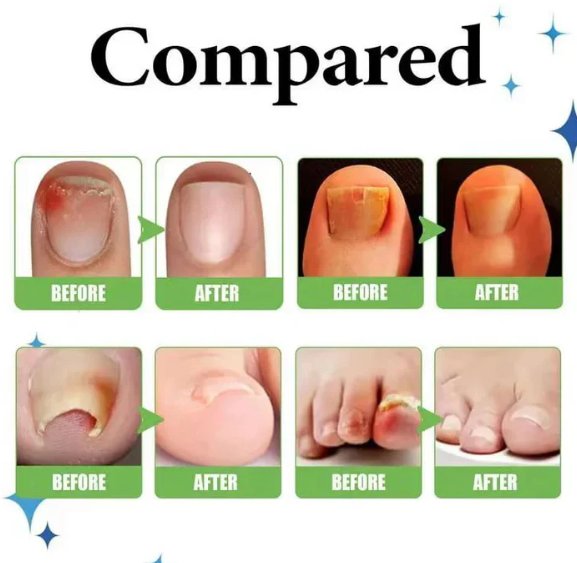 RUBRIEL NAIL REPAIR OIL