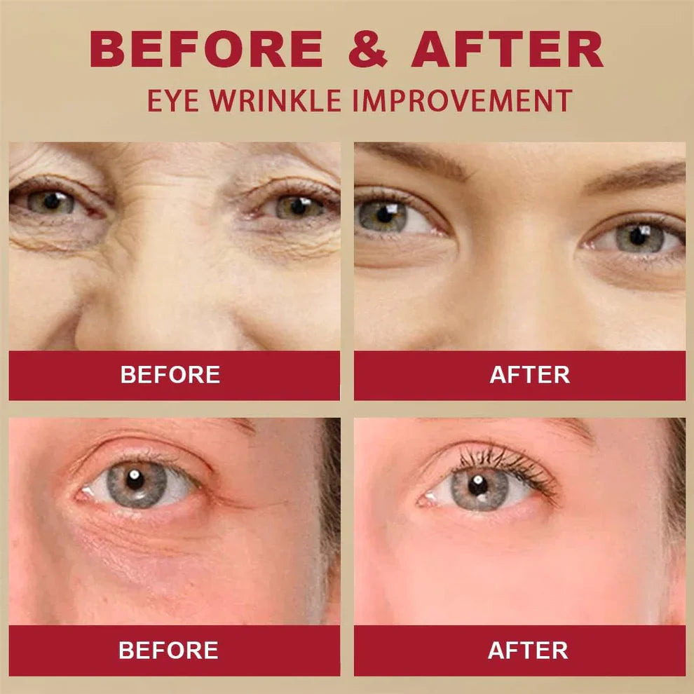 K-SECRET SEOUL 1988 Retinal Eye Cream